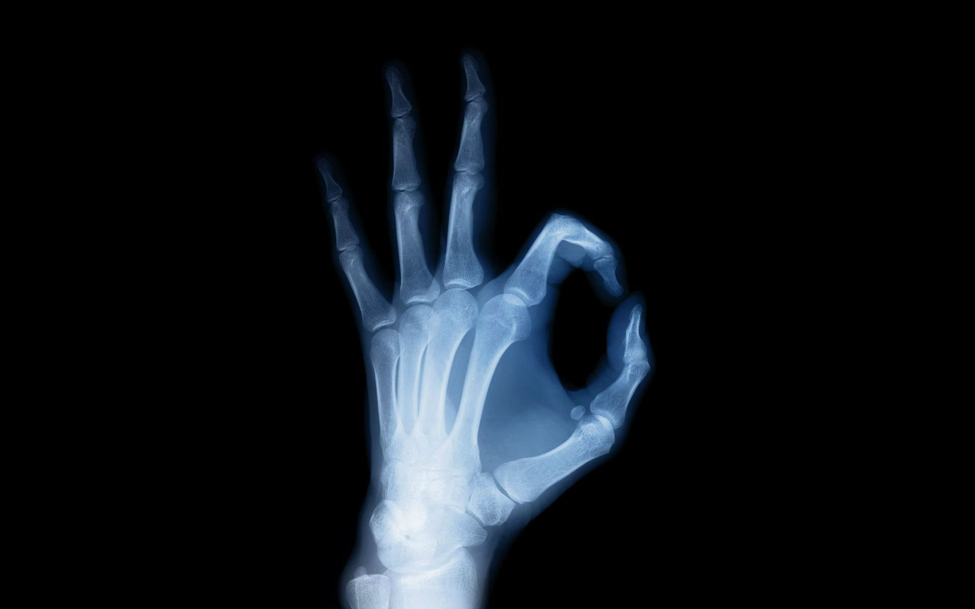 217991 descargar fondo de pantalla mano, fotografía, radiografía, anatomía, visión de rayos x: protectores de pantalla e imágenes gratis